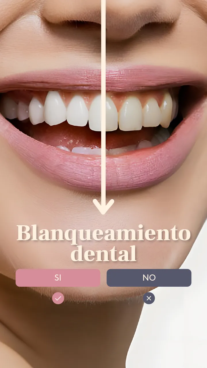 Blanqueamiento dental