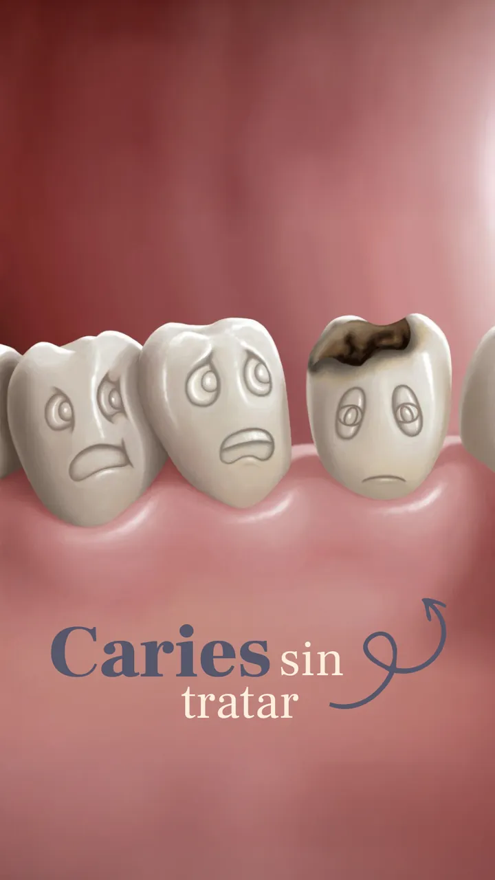 Caries sin tratar
