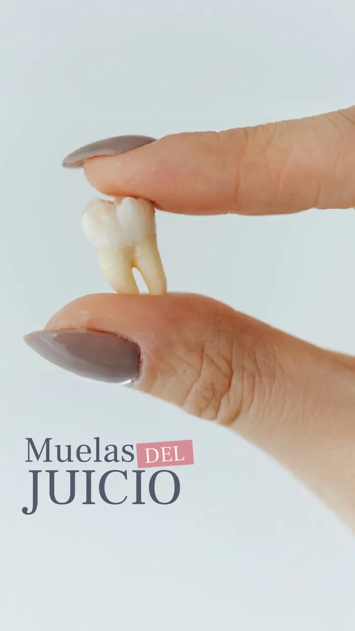 Muelas del juicio